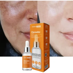Serum Melasma Clear Efeito Clareador Pele Manchas Reduz Ruga